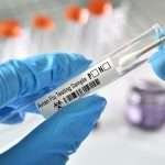 A testing swab sample for avian flu aka bird flu test